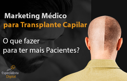 marketing médico para transplante capilar